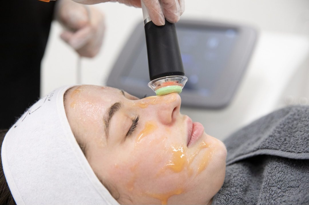 HydraFacial in Finchley